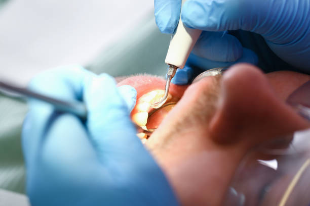 Best Tooth Infection Emergency Dentist  in Brooklyn, OH